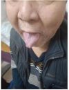 闻名天下的掌上割疗放药 一一广西百色市杨忠雅.
