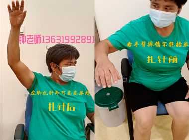 央视在线直播网特别报道 著名中医针灸专家---钟桂初